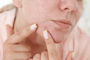 Dark Spots and Scars